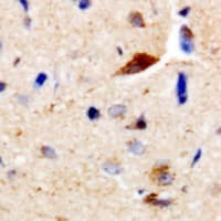 Polyclonal Rabbit anti-Human CDC25B Antibody (IHC, IF, WB)