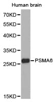 Polyclonal Rabbit anti-Human PSMA6 Antibody (IHC, WB)