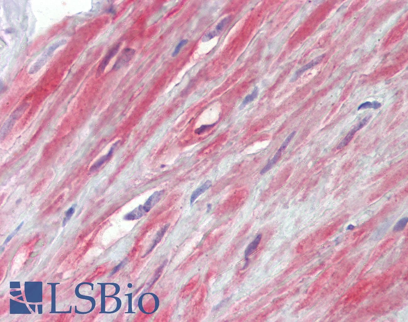 IHC-plus™ TRPC1 Antibody (aa722-733)