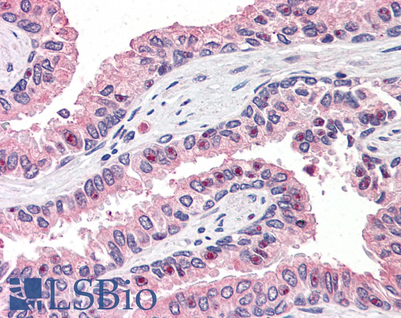 IHC-plus™ Polyclonal Rabbit anti-Human OLFM4 / Olfactomedin 4 Antibody (Internal, IHC)