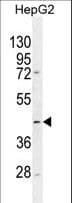 Polyclonal Rabbit anti-Human TMLHE / TMID Antibody (aa120-149, WB)