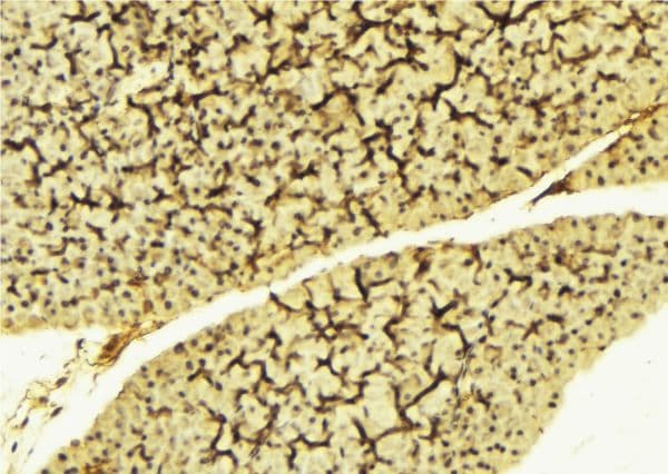 LYN Antibody