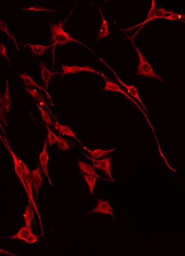 Polyclonal Rabbit anti-Human FUT3 Antibody (IHC, IF, WB)