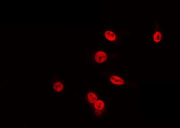 POU4F3 / BRN3C Antibody
