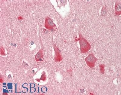 Delta-6 Desaturase / FADS2 Antibody