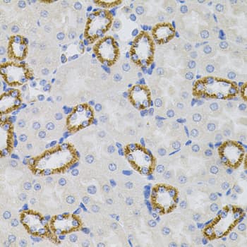IHC-plus™ Polyclonal Rabbit anti-Human OPRS1 / SIGMAR1 Antibody (IHC, WB)
