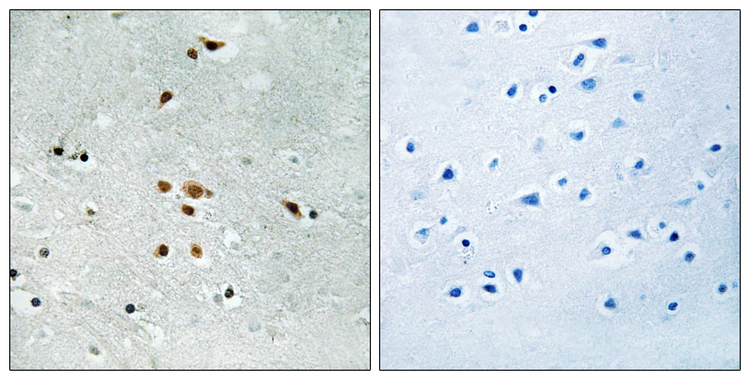 Polyclonal Rabbit anti-Human FER Antibody (phospho-Tyr402, IHC, WB)