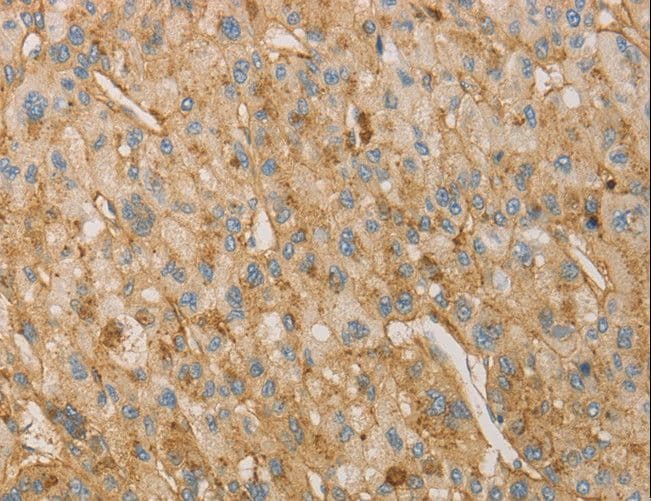 Polyclonal Rabbit anti-Human VTN / Vitronectin Antibody (IHC)