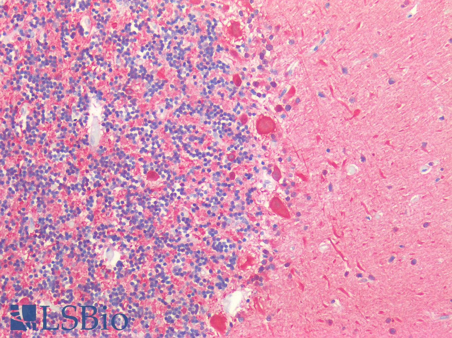 PathPlus™ UCHL1 / PGP9.5 Antibody