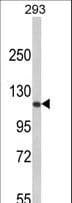 RB1 / Retinoblastoma / RB Antibody (aa858-886)