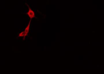 Polyclonal Rabbit anti-Human GBP1 Antibody (IF, WB)