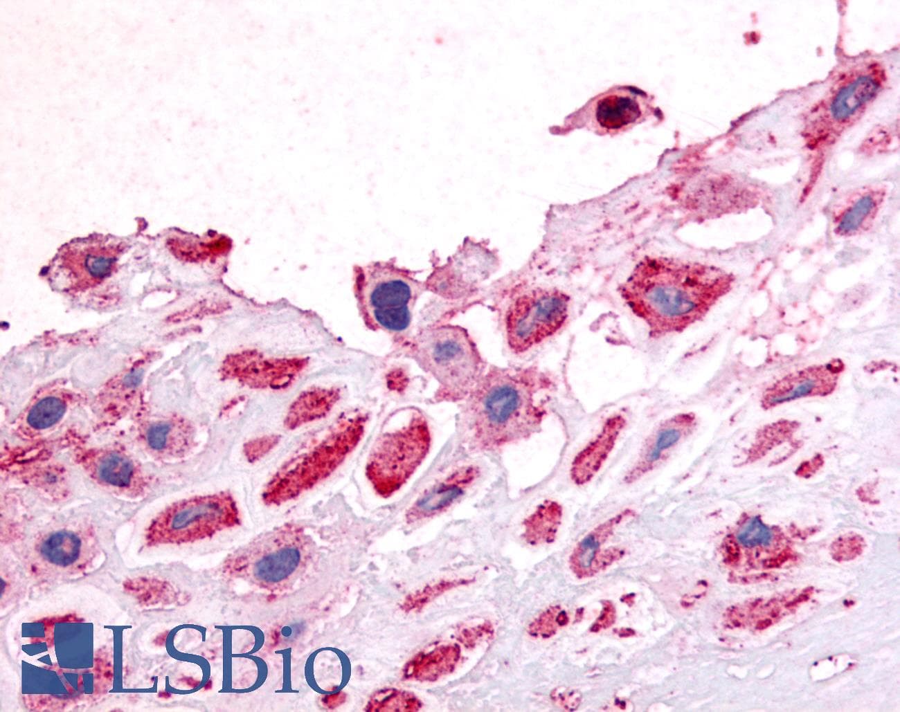 IHC-plus™ Polyclonal Rabbit anti-Human NEP / DDR1 Antibody (N-Terminus, IHC)