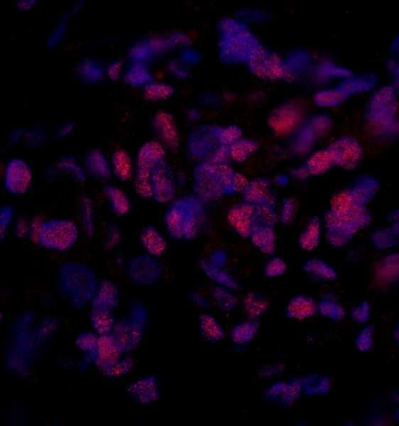SMEK2 Antibody (aa715-C-term)