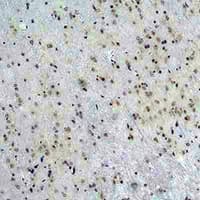 Polyclonal Rabbit anti-Human CACNG5 Antibody (IHC, WB)