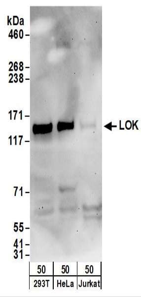 STK10 / LOK Antibody (aa350-400)