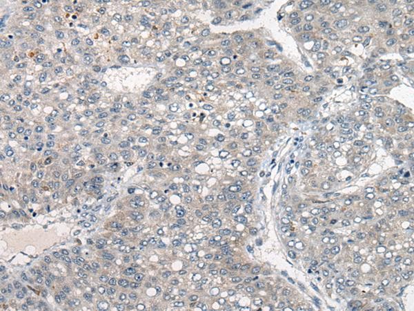 DGK-IOTA / DGKI Antibody
