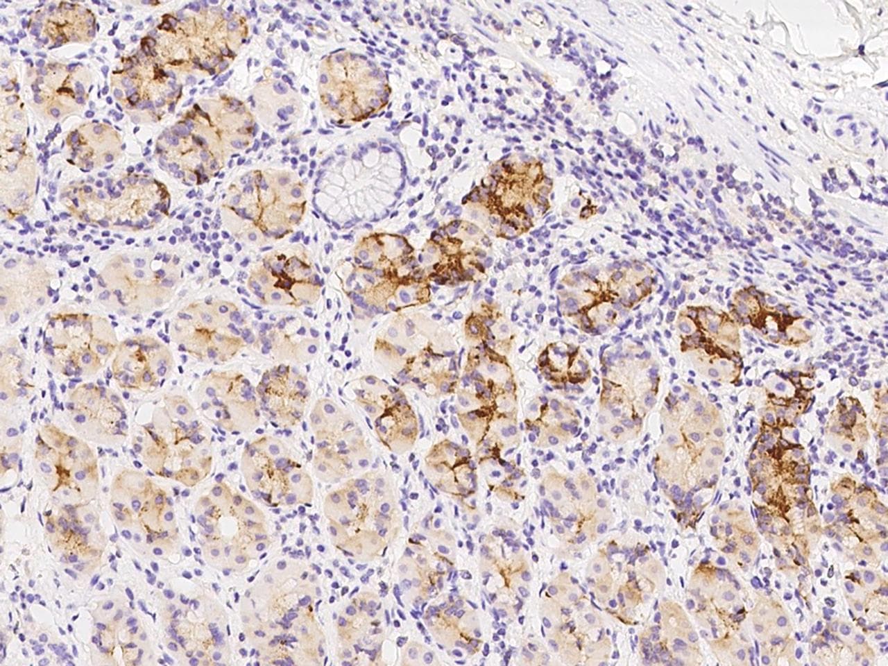 Polyclonal Rabbit anti-Human PCMT1 Antibody (IHC, WB)