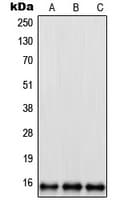 Polyclonal Rabbit anti-Human RPL35 / Ribosomal Protein L35 Antibody (Internal, IHC, WB)