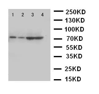 PCSK9 Antibody (aa671-687)