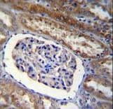 Polyclonal Rabbit anti-Human ARL8 / ARL5B Antibody (aa122-154, IHC, WB)