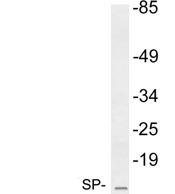 TFF2 / SP Antibody (aa35-84)