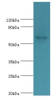 PADI4 / PAD4 Antibody (aa1-250)