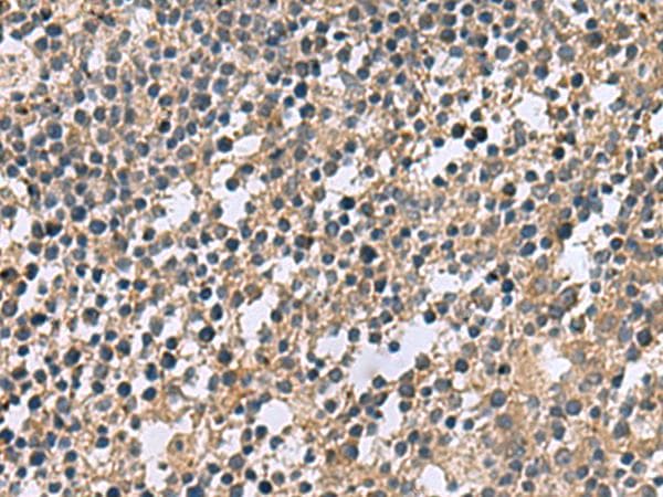 CSRP2 Antibody