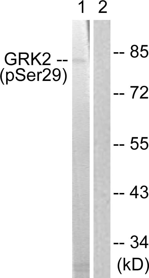 ADRBK1 / GRK2 Antibody (phospho-Ser29)