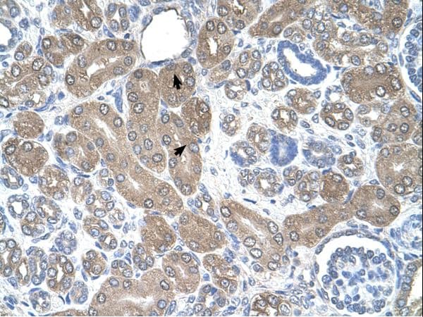 ST3GAL5 / GM3 Synthase Antibody (aa151-200)