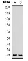 Polyclonal Rabbit anti-Human CD3D Antibody (Internal, WB)