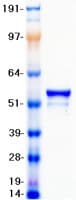 Human Vimentin Protein (Recombinant Myc-DDK (Flag))