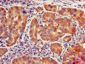 IFIT1 / ISG56 Antibody