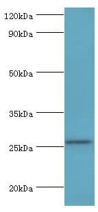 Polyclonal Rabbit anti-Human TNFSF13 / APRIL Antibody (aa105-247, IHC, WB)