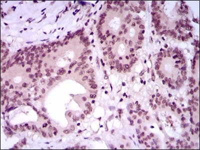 MEF2C Antibody (Amino Acid: 1-125, clone 6H2G2)