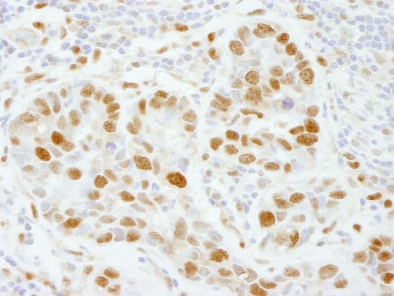 Polyclonal Rabbit anti-Human POLE3 / DNA Polymerase Epsilon Antibody (aa97-147, IHC)