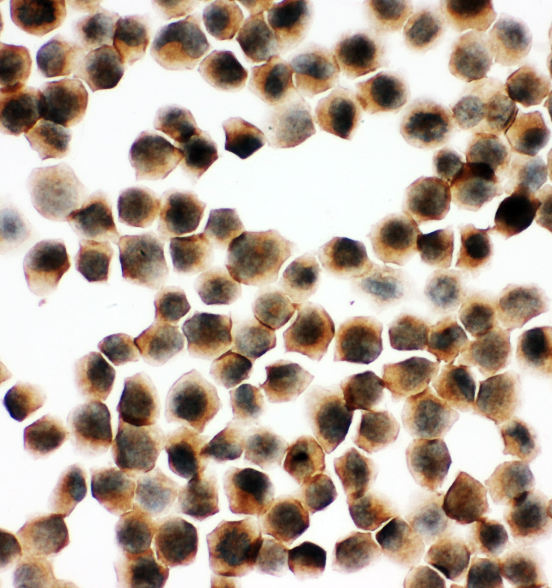 SNAP23 / SNAP-23 Antibody (aa192-211)