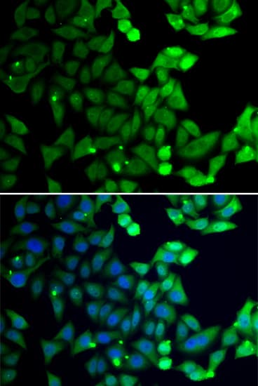 UIMC1 / RAP80 Antibody