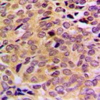 MRPL21 Antibody (Internal)