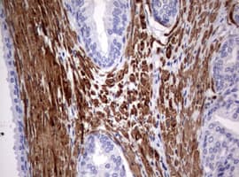 Hamartin / TSC1 Antibody (clone OTI3A2)