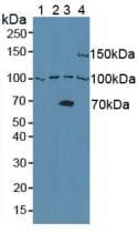 ADAM8 Antibody (aa145-493)