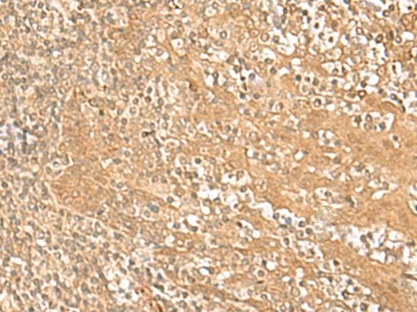 HMBOX1 Antibody
