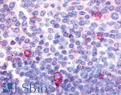IHC-plus™ Polyclonal Rabbit anti-Human CNR2 / CB2 Antibody (N-Terminus, IHC)
