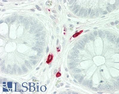 PathPlus™ Polyclonal Rabbit anti-Human TPSAB1 / Mast Cell Tryptase Antibody (IHC, IF, WB)