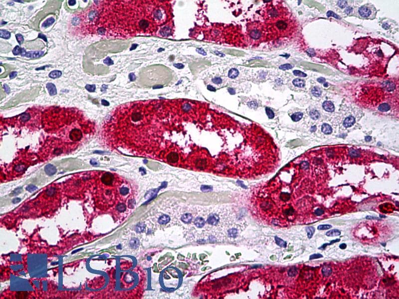 IHC-plus™ ACY1 / Aminoacylase 1 Antibody (clone 4F1-B7)