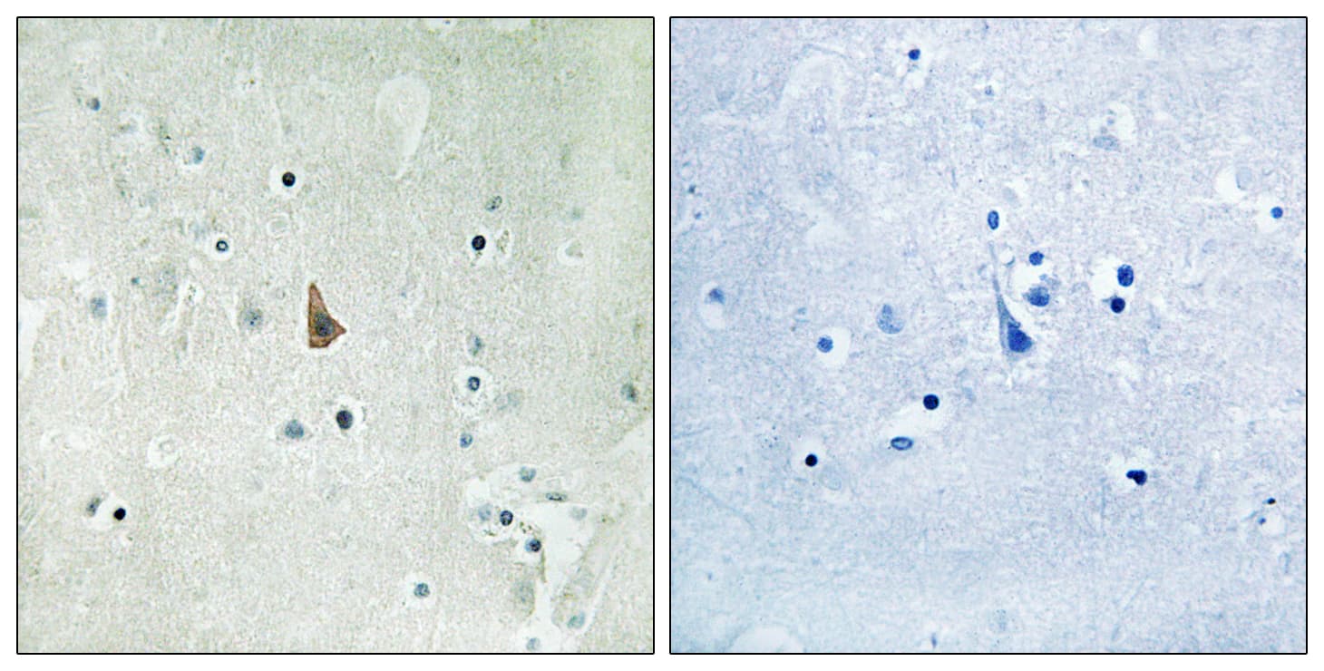 NTRK3 / TRKC Antibody (phospho-Tyr516)