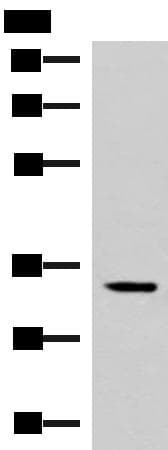FOSL2 / FRA-2 Antibody