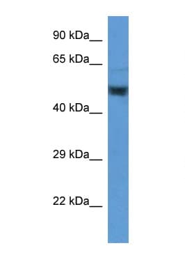 Polyclonal Rabbit anti-Human ENO2 / NSE Antibody (aa176-225, WB)
