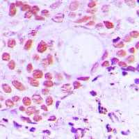 Polyclonal Rabbit anti-Human TRIM24 / TIF1 Antibody (C-Terminus, IHC, WB)