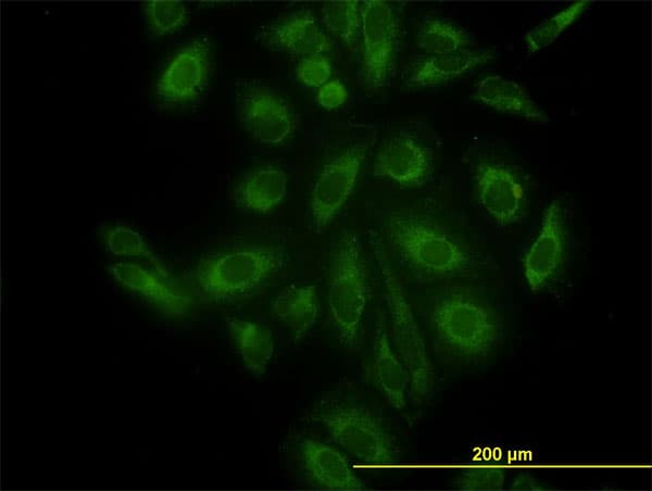 ACTR3 Antibody (clone 2B6)