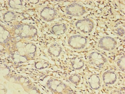 C19orf47 Antibody